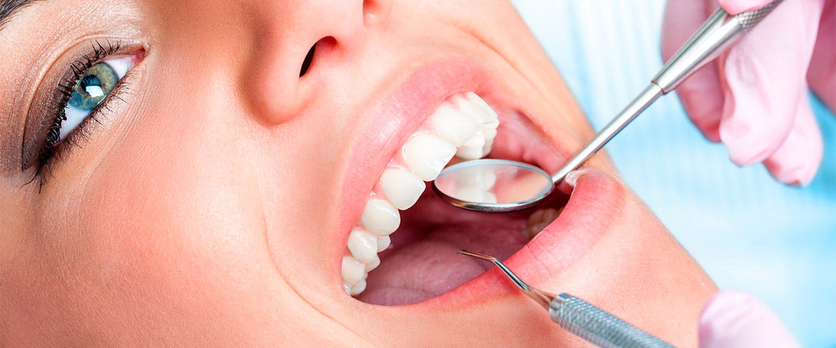 Implantes dentales Antequera