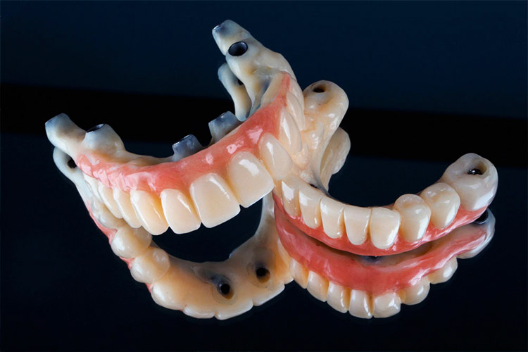 Protesis dental